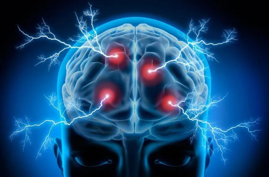 Epilepsy Myths vs. Facts: Clearing Common Misconceptions - Blog Image