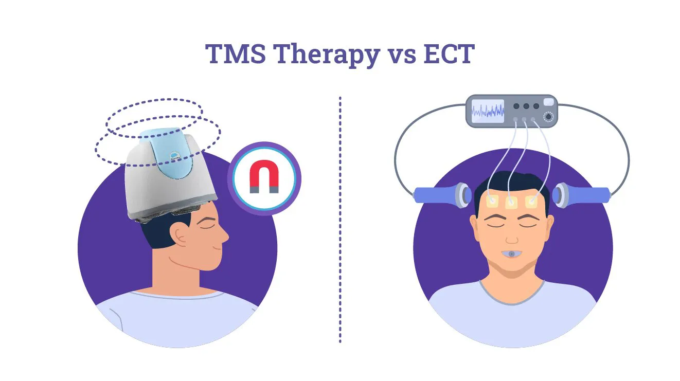 TMS vs. ECT: Understanding the Differences
