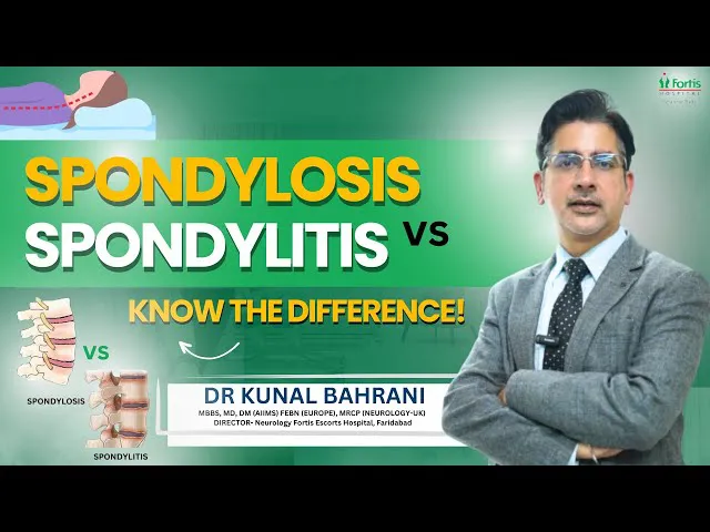 Difference between Spondylosis vs Spondylitis? | Spondylosis vs Spondylitis in Hindi | Kunal Bahrani