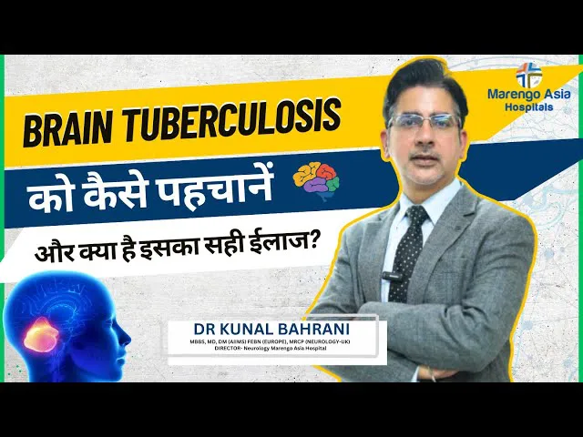 Brain Tuberculosis को कैसे पहचानें और क्या है इसका सही ईलाज? | Brain TB in Hindi | Dr. Kunal Bahrani