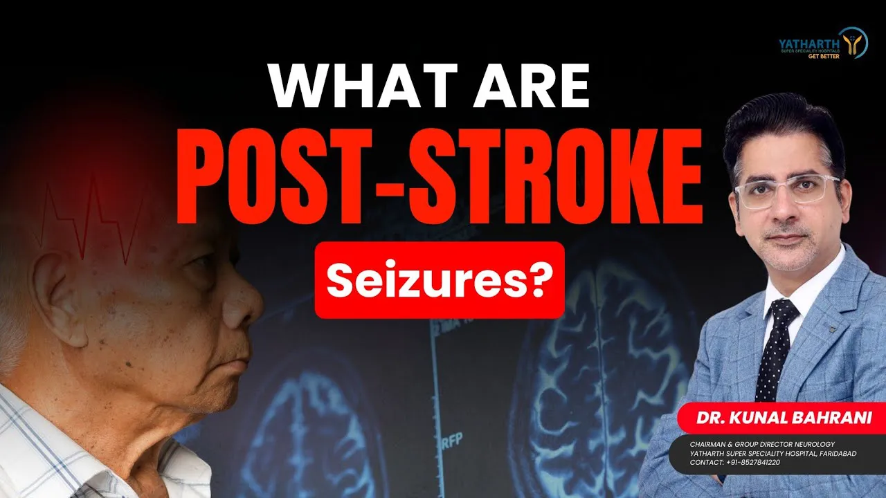 क्या Paralysis के बाद दौरा पड़ना बीमारी है? | What Are Post-Stroke Seizures? | Dr. Kunal Bahrani