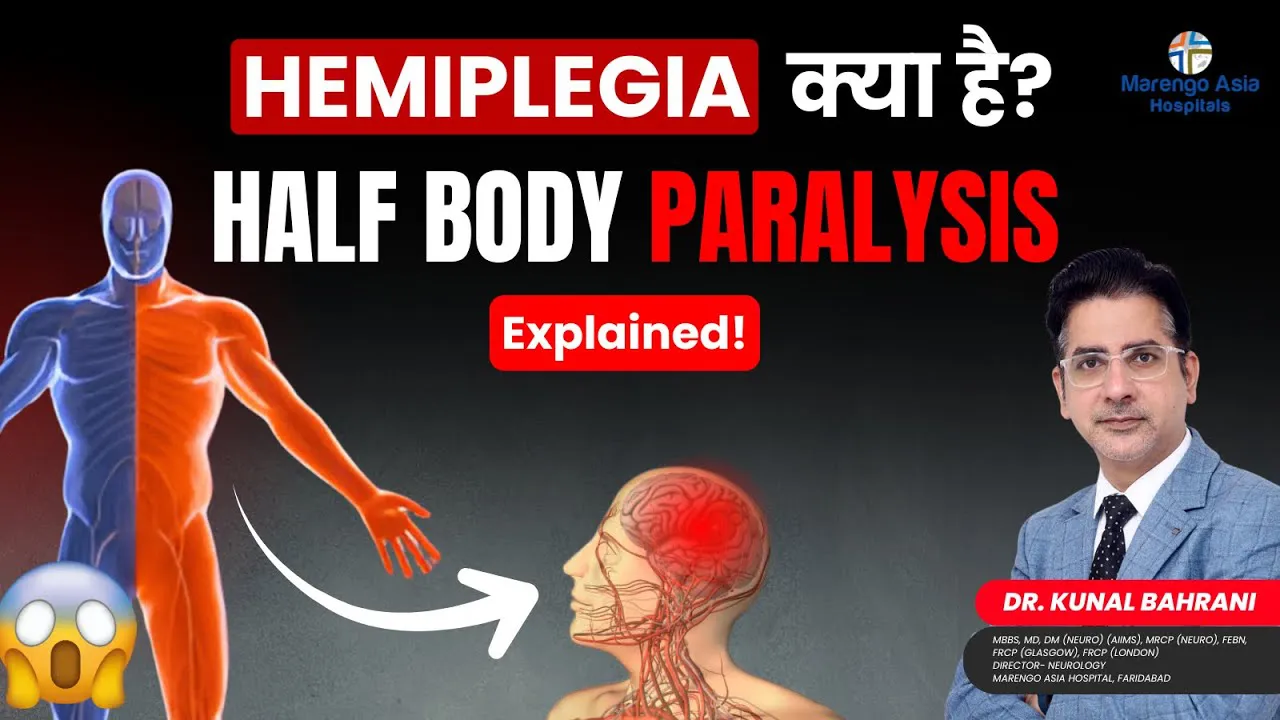 Hemiplegia क्या है? | Half Body Paralysis Explained in Hindi | Dr. Kunal Bahrani
