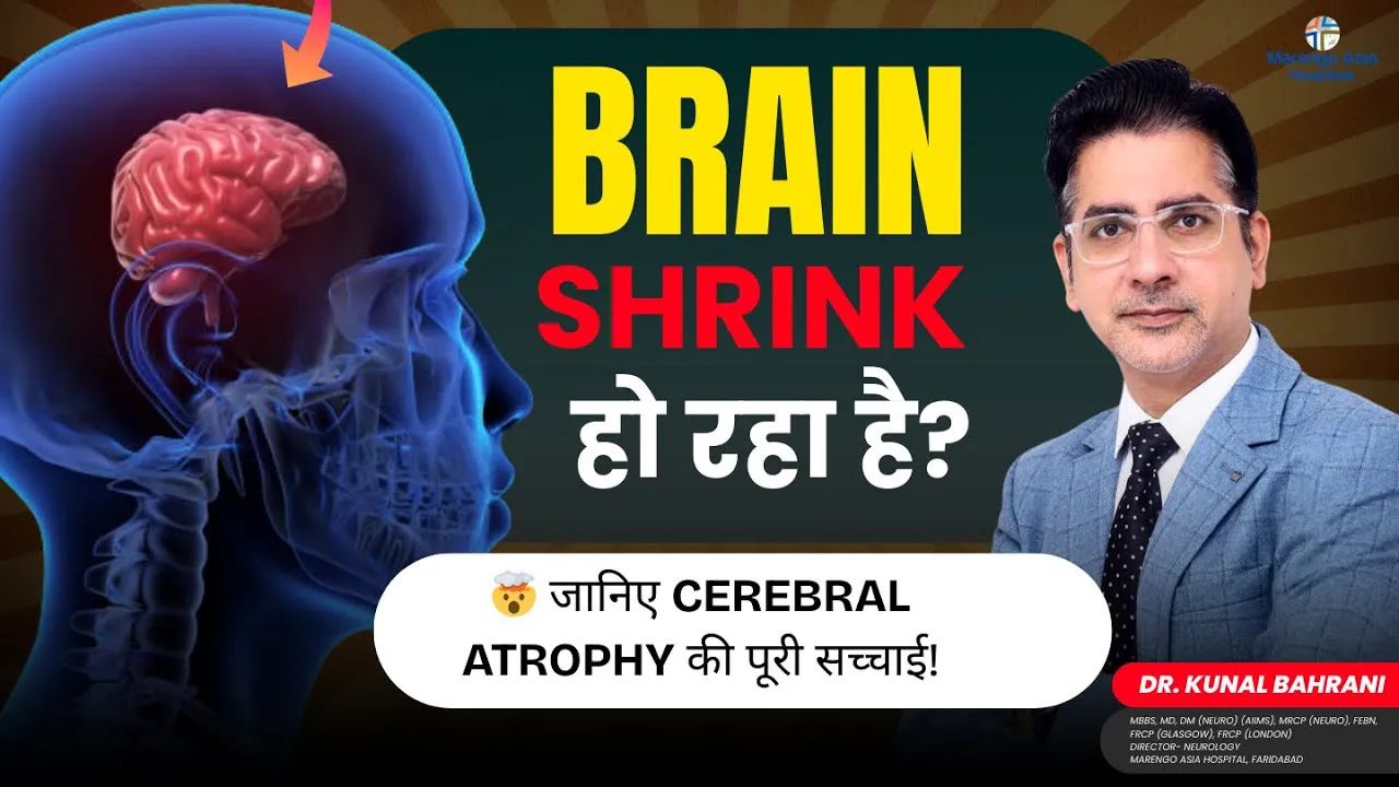 Brain Shrink हो रहा है? 🤯 जानिए Cerebral Atrophy की पूरी सच्चाई! | Cerebral Atrophy | Dr. Kunal