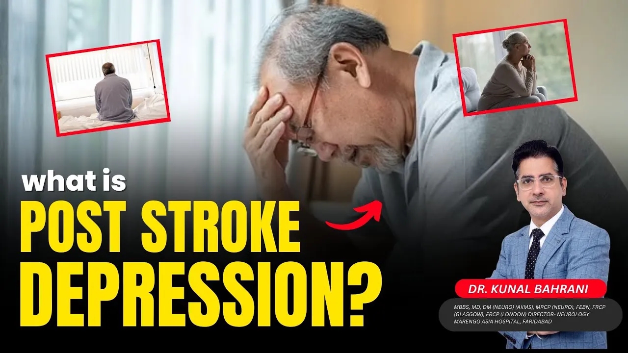 पैरालिसिस अटैक के बाद होने वाले मानसिक रोग | Post Stroke Depression in Hindi | Dr. Kunal Bahrani