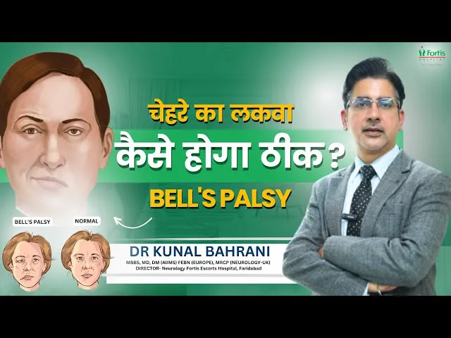 चेहरे का लकवा कैसे होगा ठीक? | Bell's Palsy: causes, symptoms & treatment | Dr. Kunal Bahrani