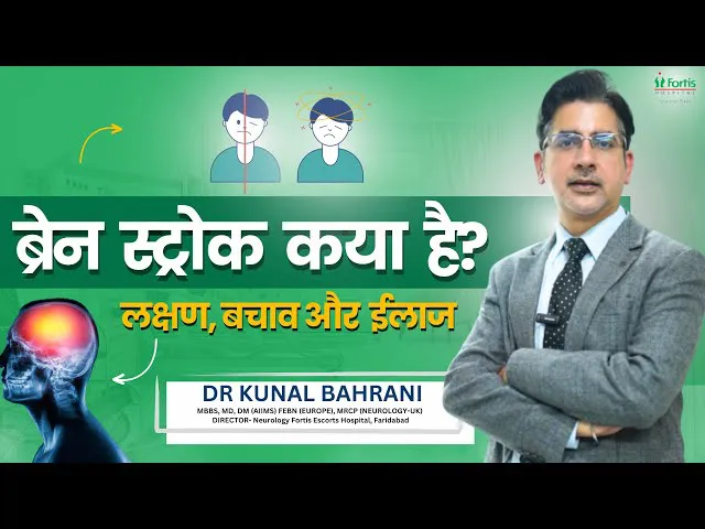 ब्रेन स्ट्रोक कया है : लक्षण, बचाव और ईलाज | Brain Stroke in Hindi | Dr. Kunal Bahrani | Neurologist