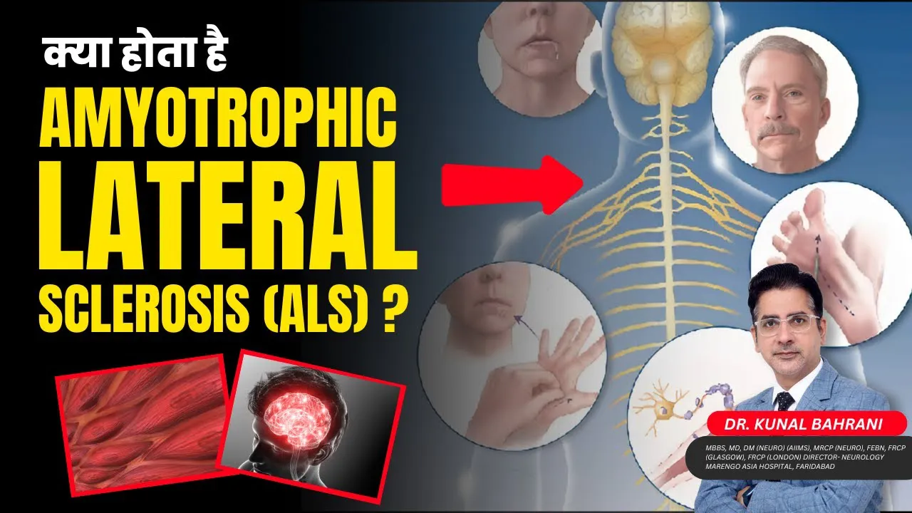 क्या होता है Amyotrophic Lateral Sclerosis? | Motor Neuron Disease in Hindi | Dr. Kunal Bahrani