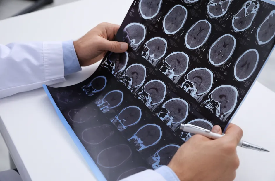 So, Who Really Is the Best Neurologist in Faridabad City?